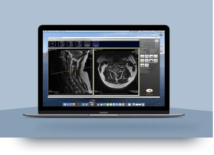 Nautilus