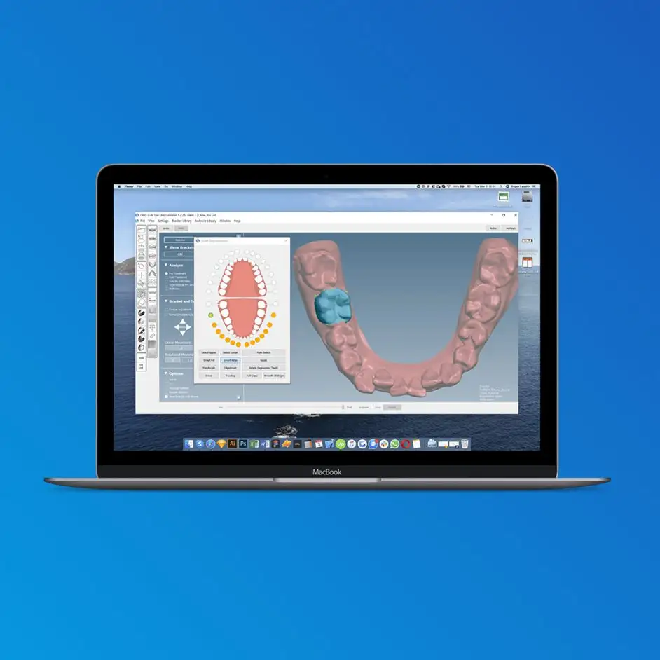 OrthoSelect