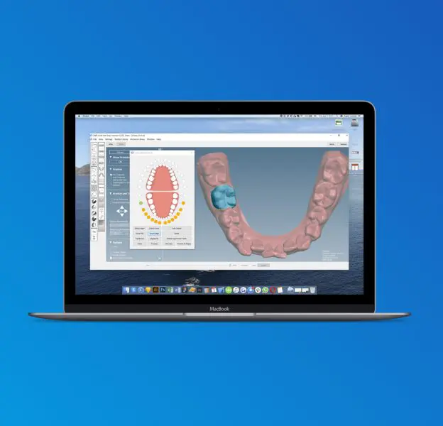 OrthoSelect