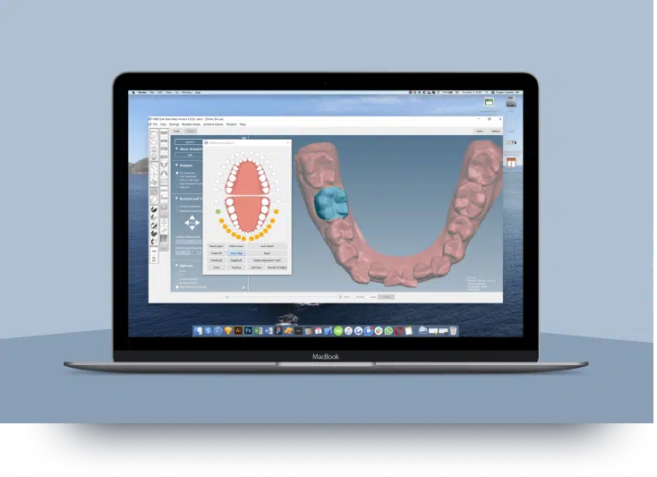 Orthoselect